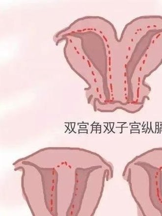 采卵后卵巢功能下降快，9细胞2级胚胎质量好不好