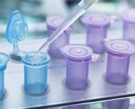 怀孕试管如何调理身体？北京哪家医院是试管口碑较好的医院？