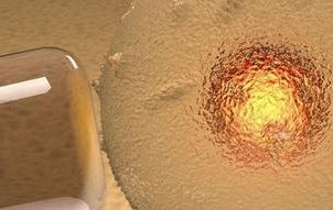 详细解读宜都市做长方案试管婴儿费用，长方案和短方案成功率有差别吗？