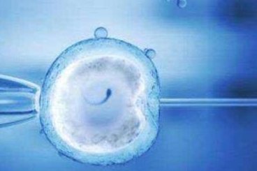 上哪去做试管婴儿（去哪里做试管婴儿成功率高）